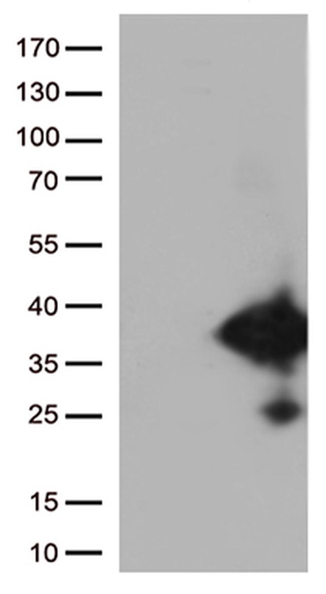 EFHD1 Antibody in Western Blot (WB)