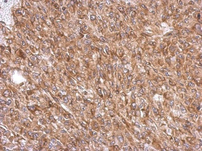 EFHD2 Antibody in Immunohistochemistry (IHC)