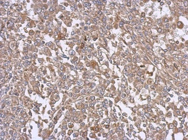EFHD2 Antibody in Immunohistochemistry (IHC)