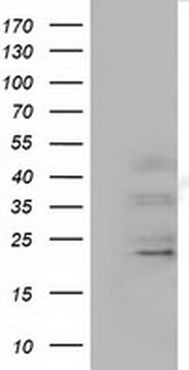 EFNA2 Antibody in Western Blot (WB)