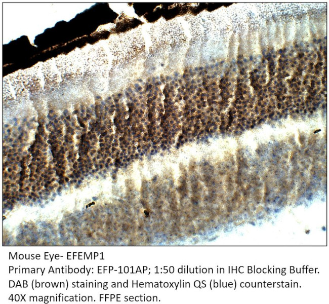 EFEMP1 Antibody in Immunohistochemistry (IHC)