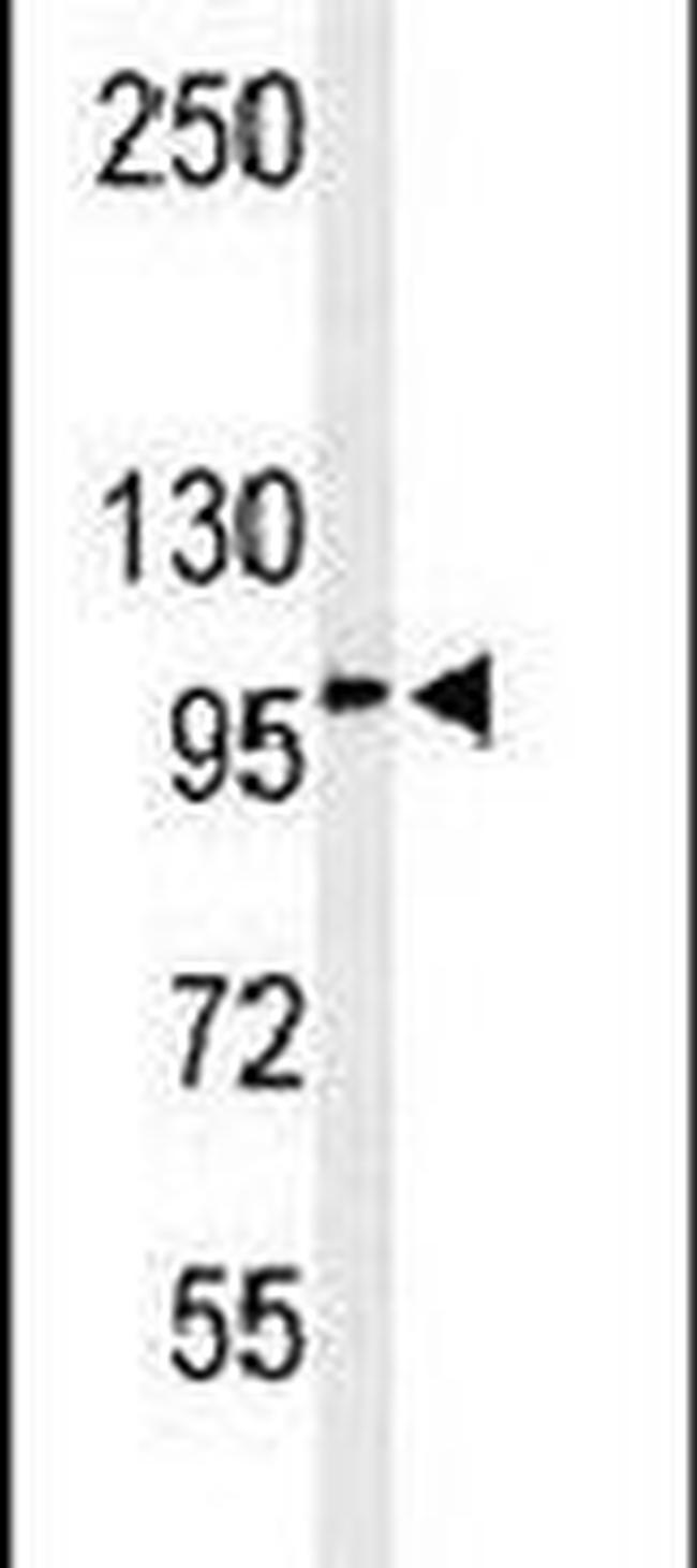 EFR3A Antibody in Western Blot (WB)