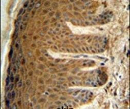 EFTUD2 Antibody in Immunohistochemistry (IHC)