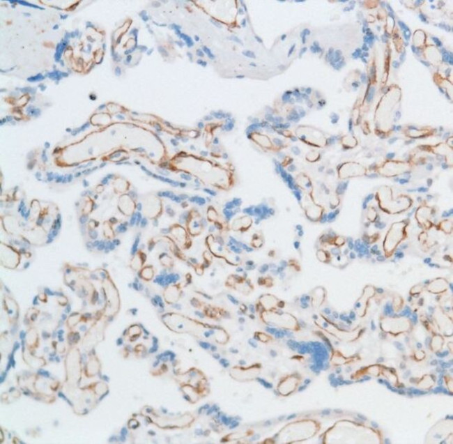 EGFL7 Antibody in Immunohistochemistry (IHC)