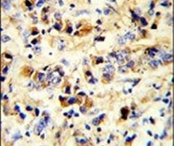 EGFR Antibody in Immunohistochemistry (IHC)