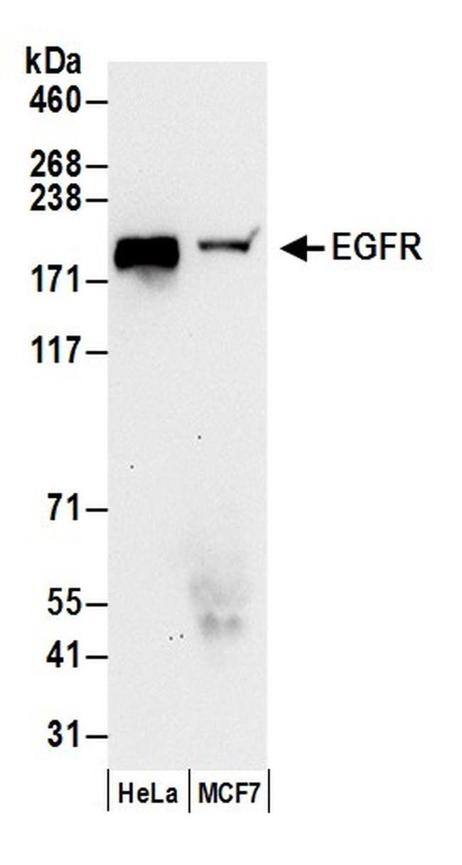 EGFR Antibody in Western Blot (WB)
