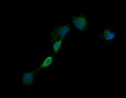 EGFR Antibody in Immunocytochemistry (ICC/IF)
