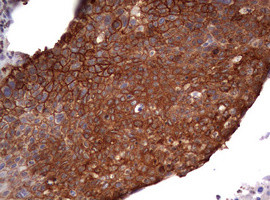 EGFR Antibody in Immunohistochemistry (Paraffin) (IHC (P))