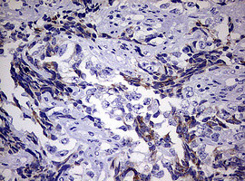 EGFR Antibody in Immunohistochemistry (Paraffin) (IHC (P))