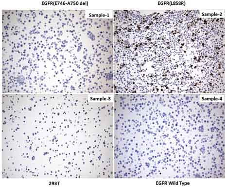 EGFR L858R Antibody in Immunocytochemistry (ICC/IF)