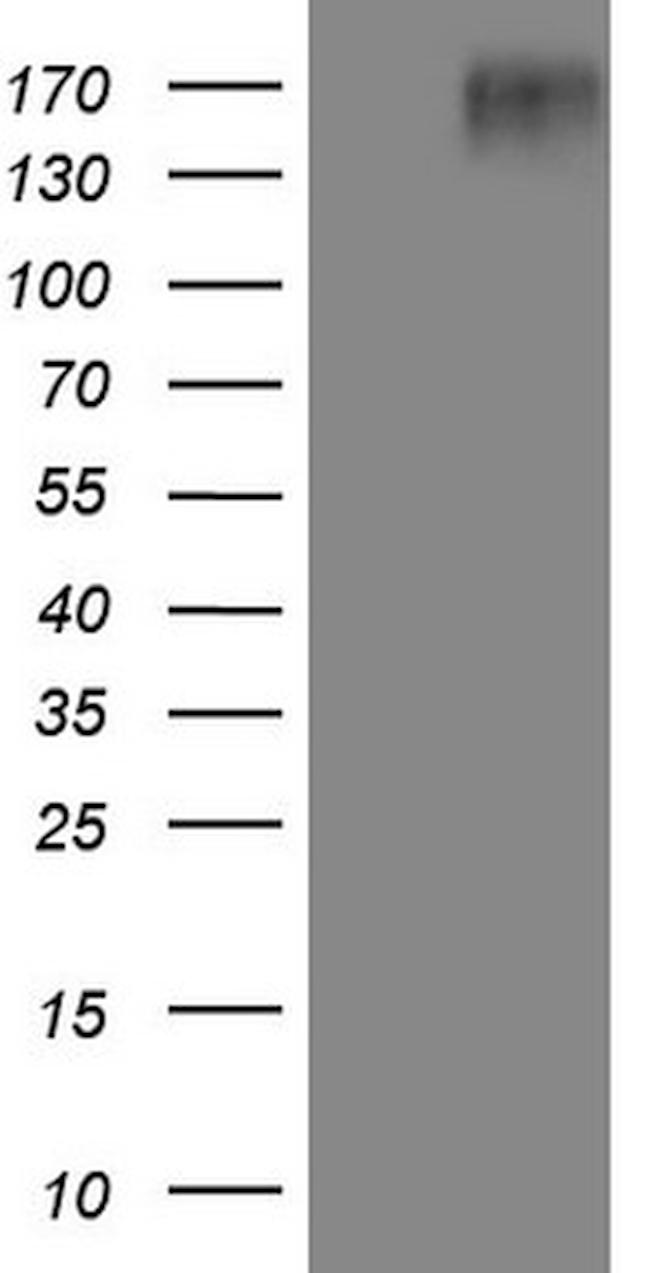 EGFR L858R Antibody in Western Blot (WB)
