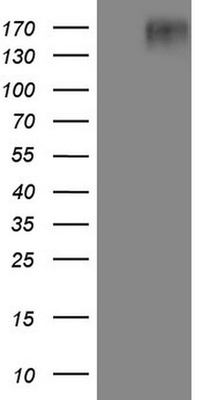 EGFR L858R Antibody in Western Blot (WB)
