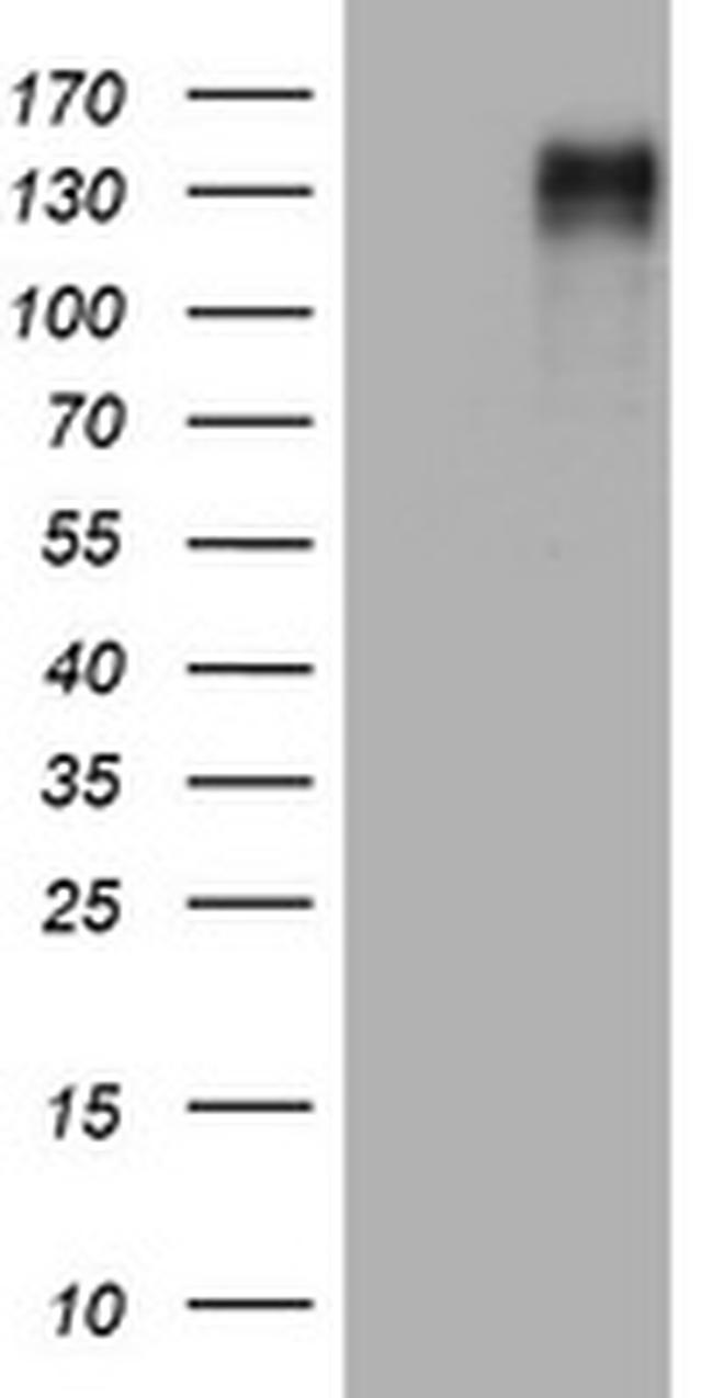EGFR Antibody in Western Blot (WB)