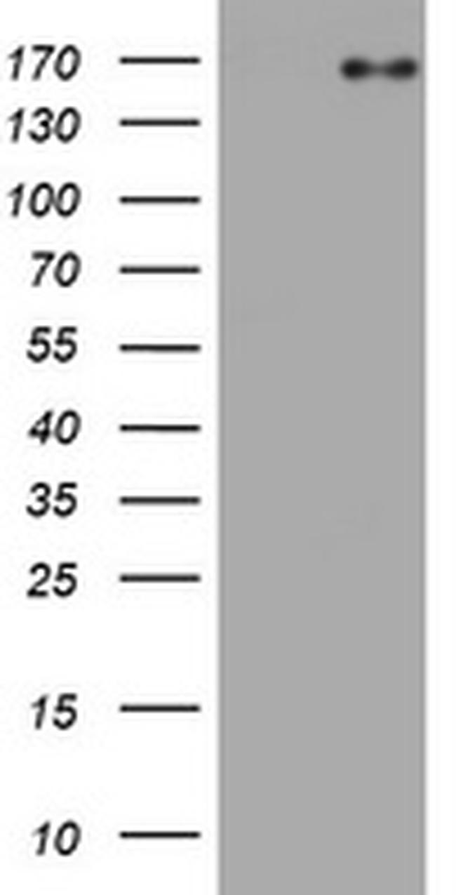EGFR Antibody in Western Blot (WB)