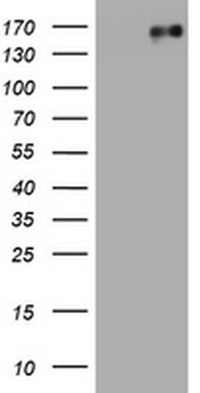 EGFR Antibody in Western Blot (WB)