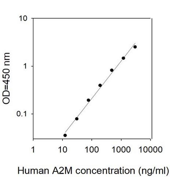 Human Alpha 2-M ELISA Kit