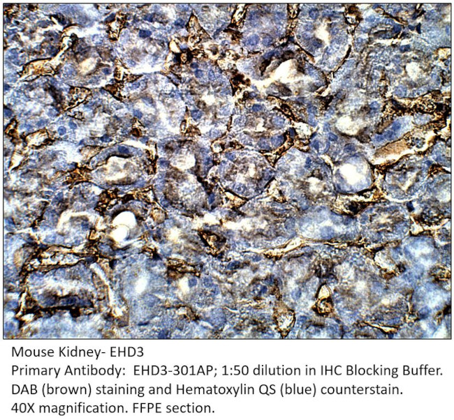 EHD3 Antibody in Immunohistochemistry (IHC)