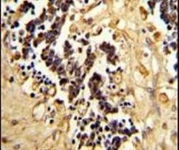 EHD3 Antibody in Immunohistochemistry (IHC)