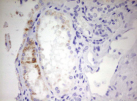 EHHADH Antibody in Immunohistochemistry (Paraffin) (IHC (P))
