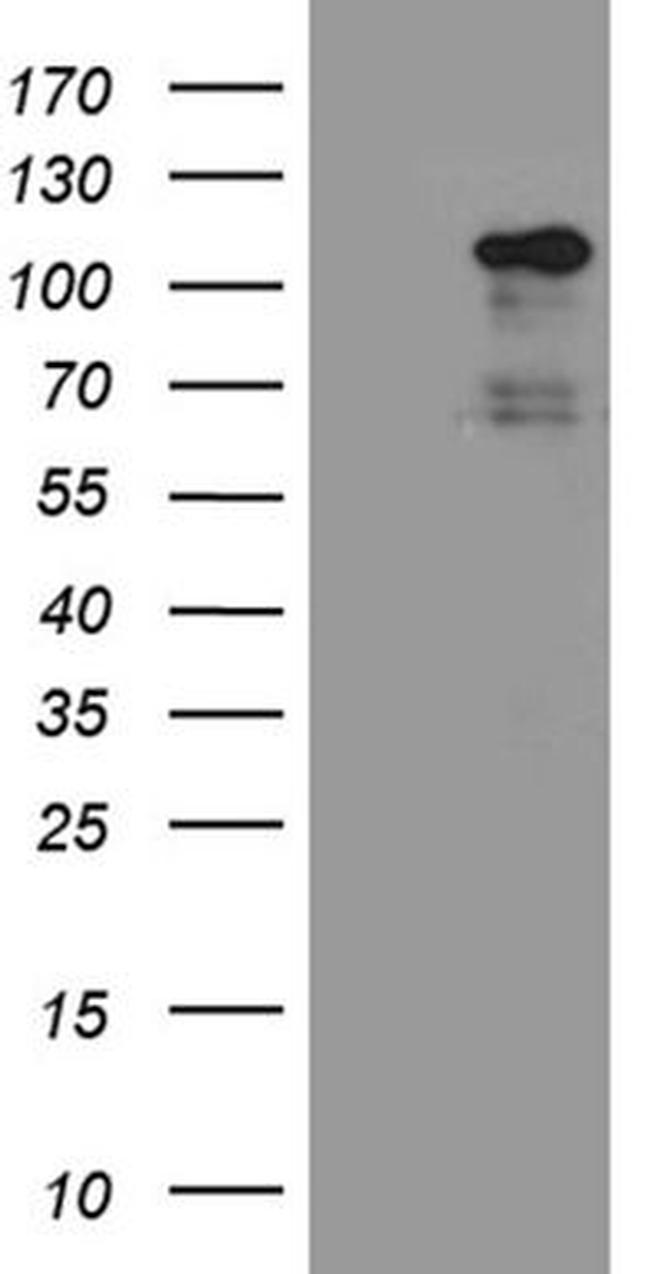 EIF2C1 Antibody in Western Blot (WB)