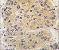eIF4A1 Antibody in Immunohistochemistry (IHC)