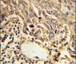eIF4A2 Antibody in Immunohistochemistry (IHC)