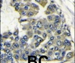eIF4B Antibody in Immunohistochemistry (IHC)