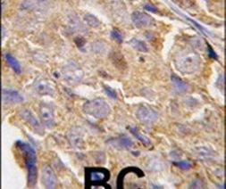 eIF4B Antibody in Immunohistochemistry (IHC)