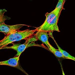 eIF4B Antibody in Immunocytochemistry (ICC/IF)