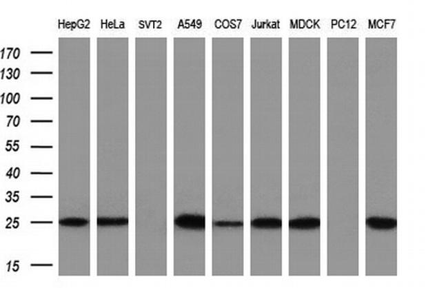 EIF4E Antibody in Western Blot (WB)