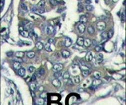 eIF4E2 Antibody in Immunohistochemistry (IHC)