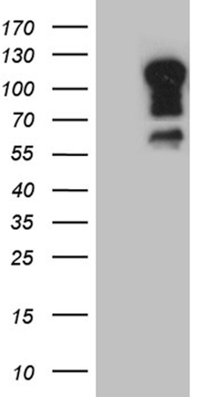 ELF1 Antibody in Western Blot (WB)