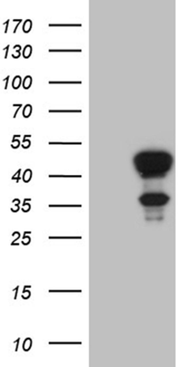 ELF3 Antibody in Western Blot (WB)