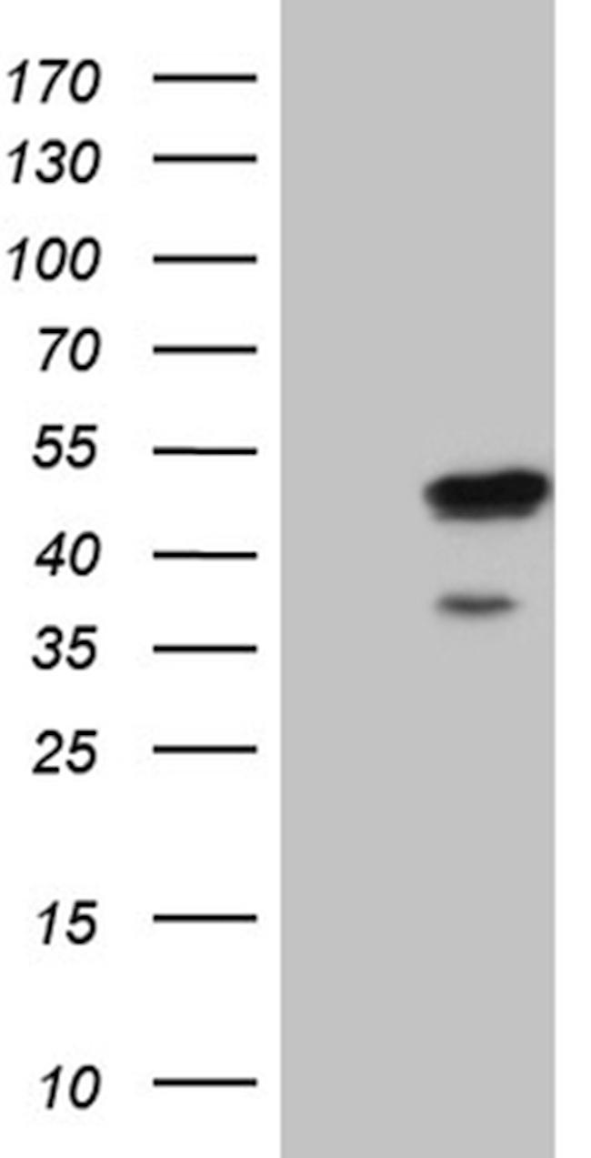 ELF3 Antibody in Western Blot (WB)