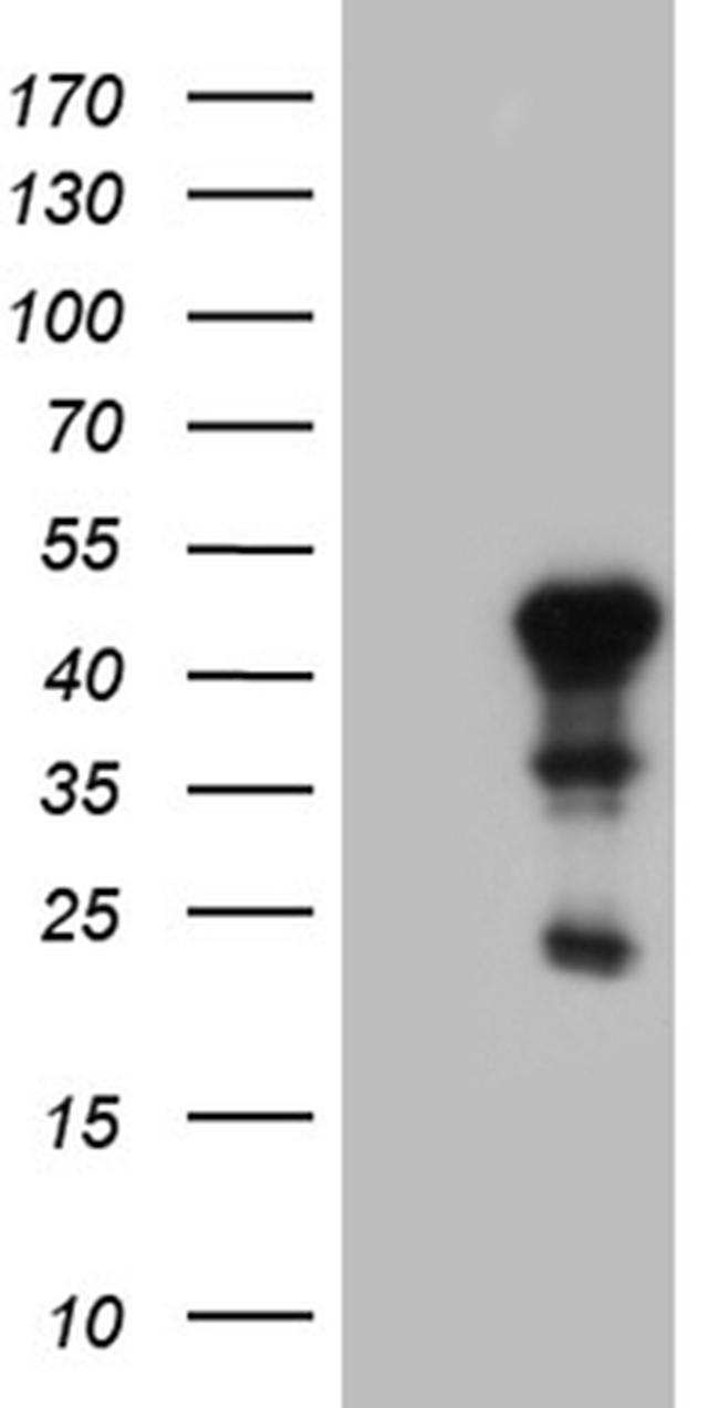 ELF3 Antibody in Western Blot (WB)