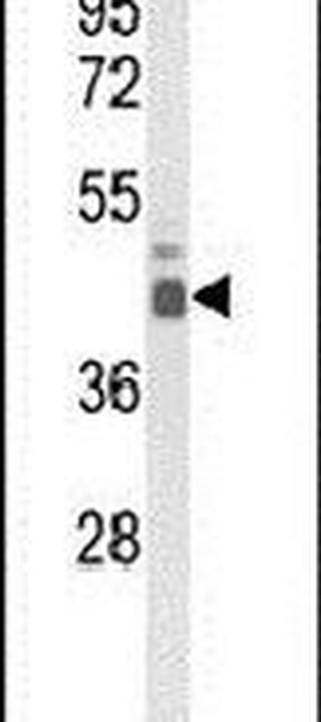 ELF3 Antibody in Western Blot (WB)
