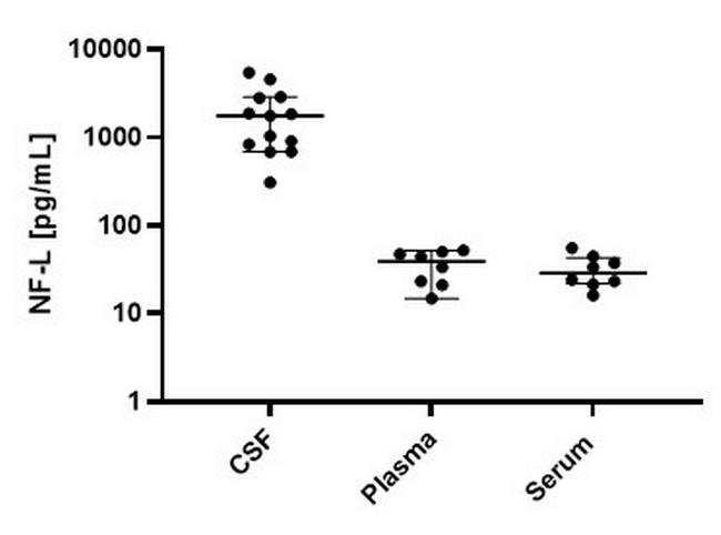 Human NF-L ELISA Kit