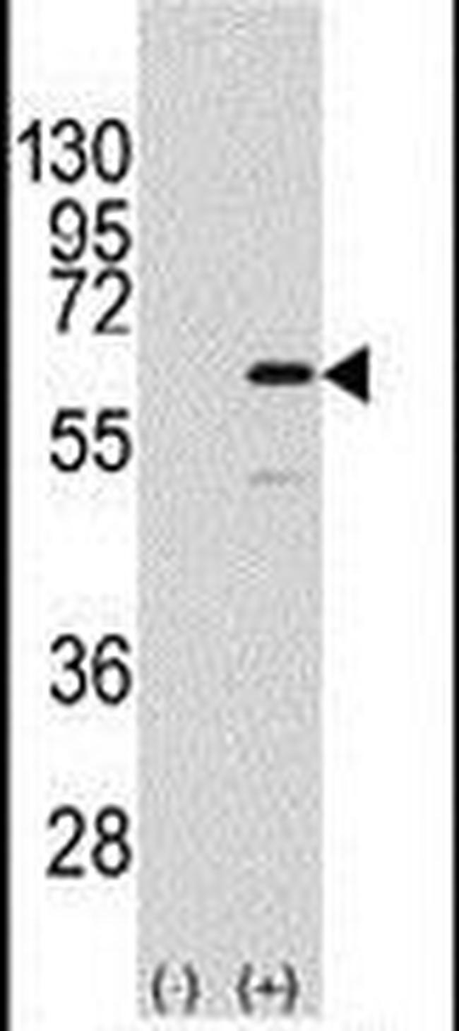 ELK1 Antibody in Western Blot (WB)