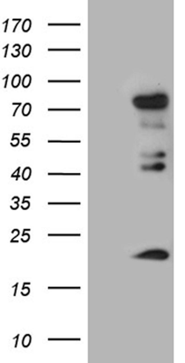 ELL Antibody in Western Blot (WB)