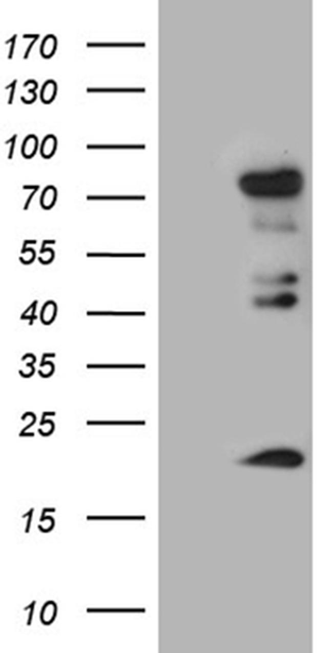 ELL Antibody in Western Blot (WB)