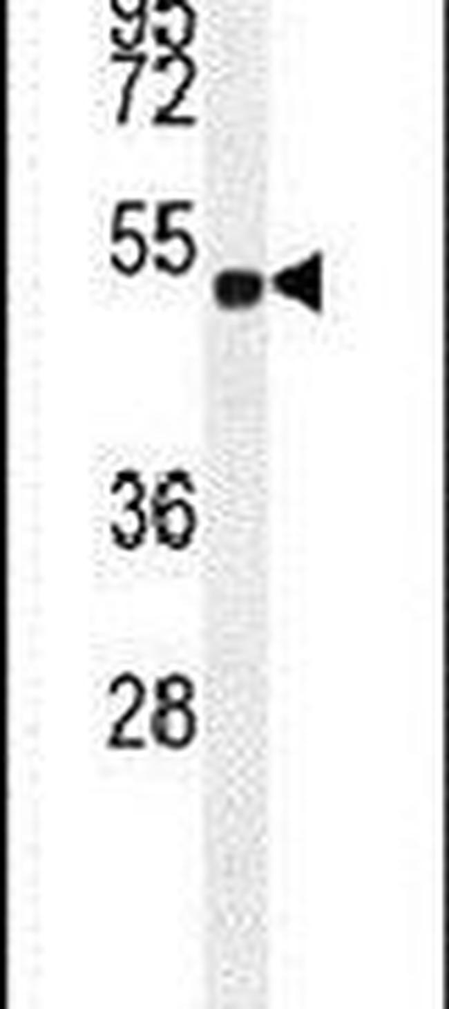 ELL Antibody in Western Blot (WB)