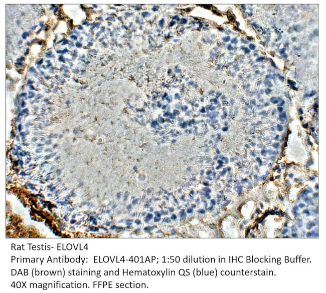 ELOVL4 Antibody in Immunohistochemistry (IHC)