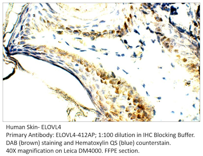 ELOVL4 Antibody in Immunohistochemistry (IHC)