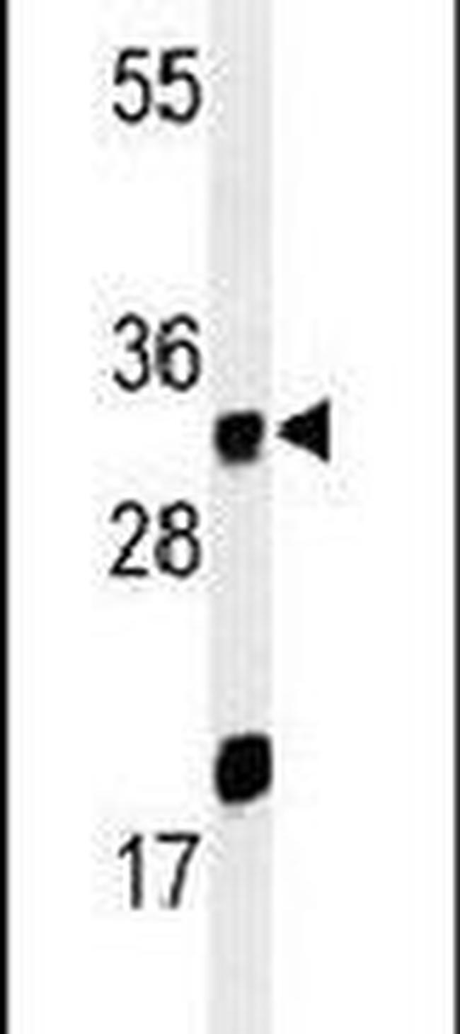 ELOVL5 Antibody in Western Blot (WB)