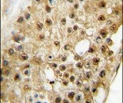 ELP3 Antibody in Immunohistochemistry (IHC)