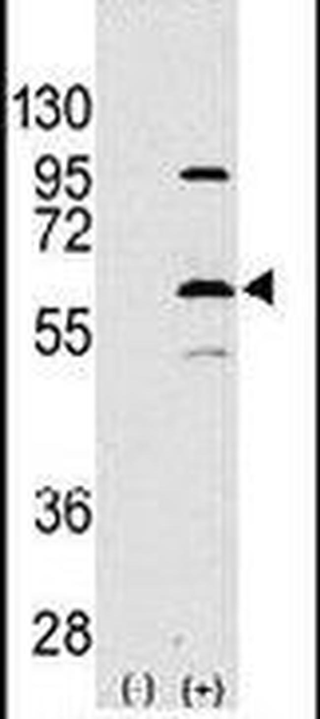 ELP3 Antibody in Western Blot (WB)