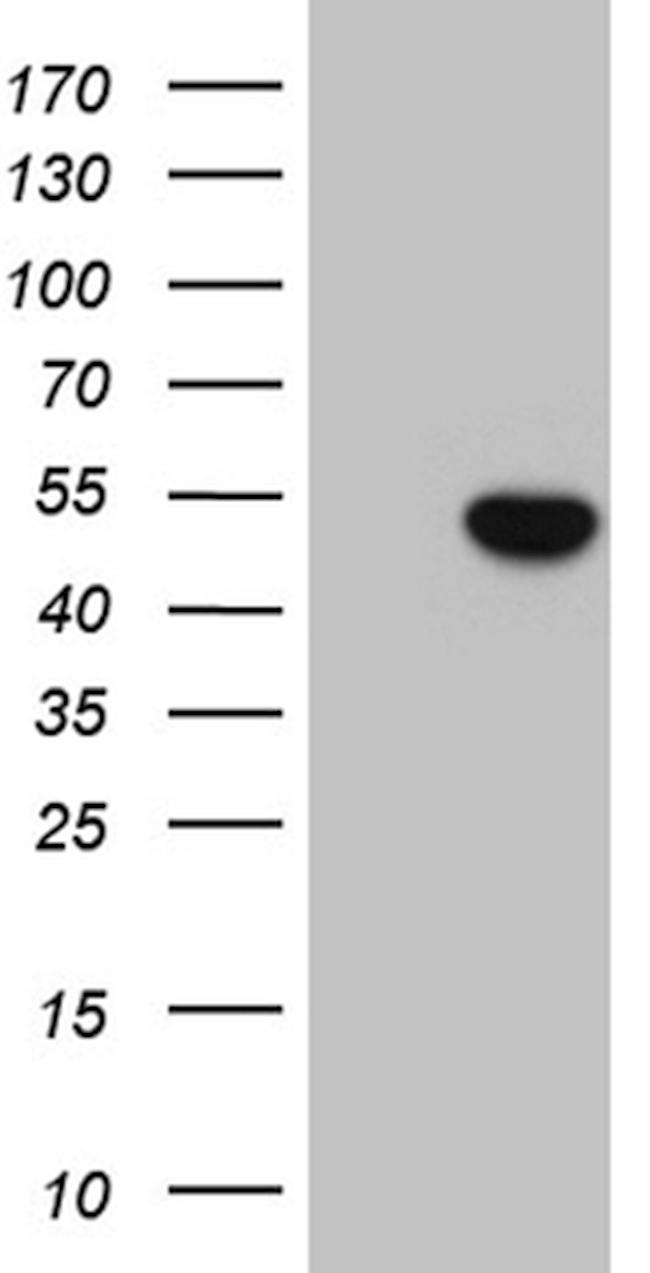 ELP4 Antibody in Western Blot (WB)