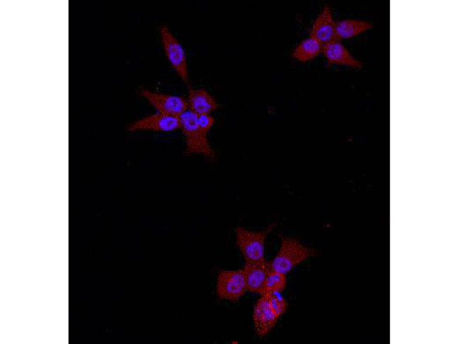 Beta-Catenin Antibody in Immunocytochemistry (ICC/IF)