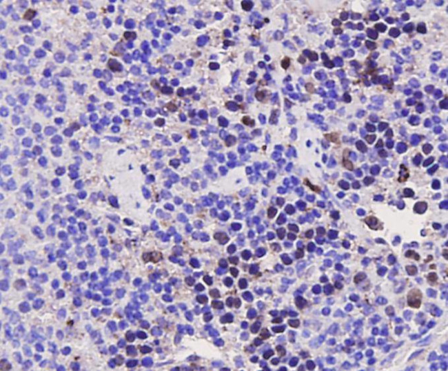 PCNA Antibody in Immunohistochemistry (Paraffin) (IHC (P))