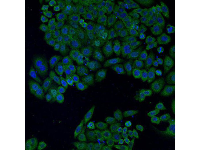 BAX Antibody in Immunocytochemistry (ICC/IF)